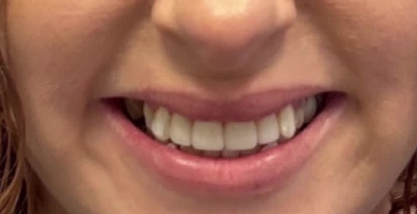 After