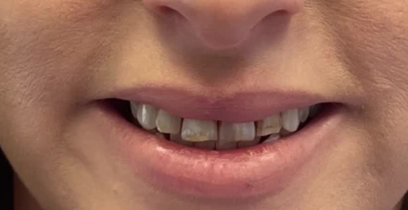 Before